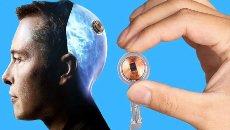 China desafía a Elon Musk con su propio chip cerebral