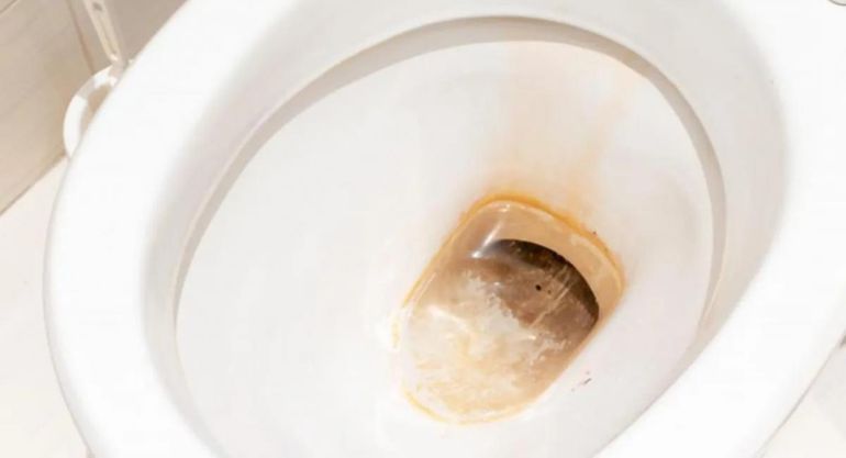 El secreto para eliminar el sarro del inodoro: método sencillo y rápido que sorprende a todos