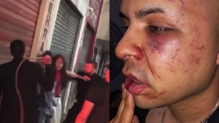 Patovicas atacaron a latigazos a un joven a la salida de un boliche