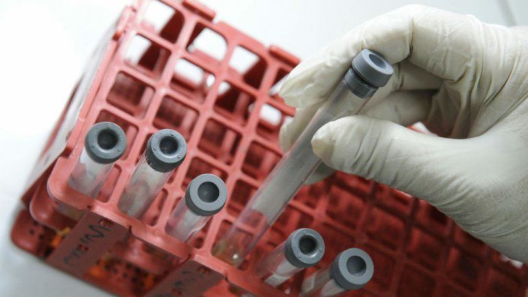 La investigación se originó a partir de los medicamentos antirretrovirales.