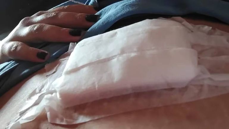 La mujer apuñalada en el recital de La Renga sufrió una herda de tres puntos en el estómago. Foto: Facebook. La mujer apuñalada en el recital de La Renga sufrió una herda de tres puntos en el estómago. Foto: Facebook.