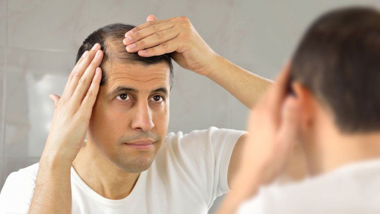 Hombres o mujeres: ¿a quién se le cae más el cabello?
