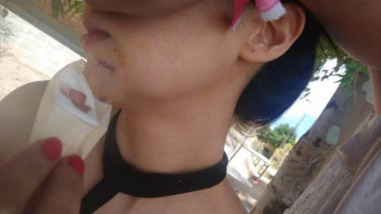 Violencia de género: agredió a una joven a la salida del boliche en Plaza Huincul