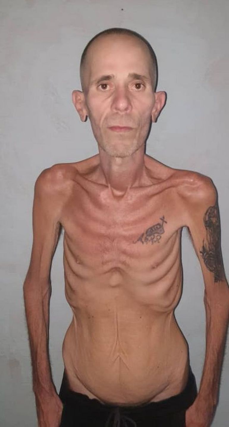 Organizaciones internacionales advierten por el deterioro de presos políticos en Cuba y reclaman mayor control sobre el sistema penitenciario. Organizaciones internacionales advierten por el deterioro de presos políticos en Cuba y reclaman mayor control sobre el sistema penitenciario.