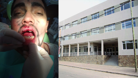Brutal golpiza: Fui a buscar mi campera y me desfiguró