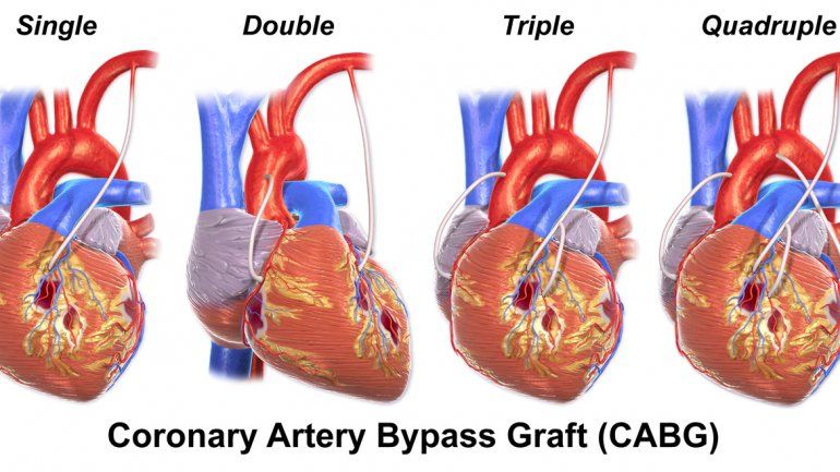 Favaloro nació en La Plata y estudió medicina en la universidad nacional de esa ciudad bonaerense