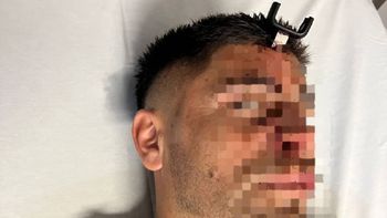 le clavaron una llave de auto en la cabeza a un jugador del ascenso durante un partido de futbol femenino le clavaron una llave de auto en la cabeza a un jugador del ascenso durante un partido de futbol femenino