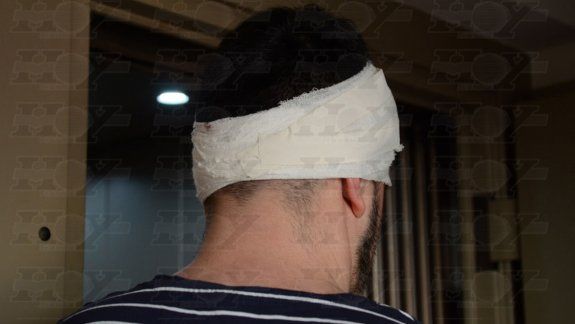 Balearon a un estudiante de Cutral Co en La Plata en un robo