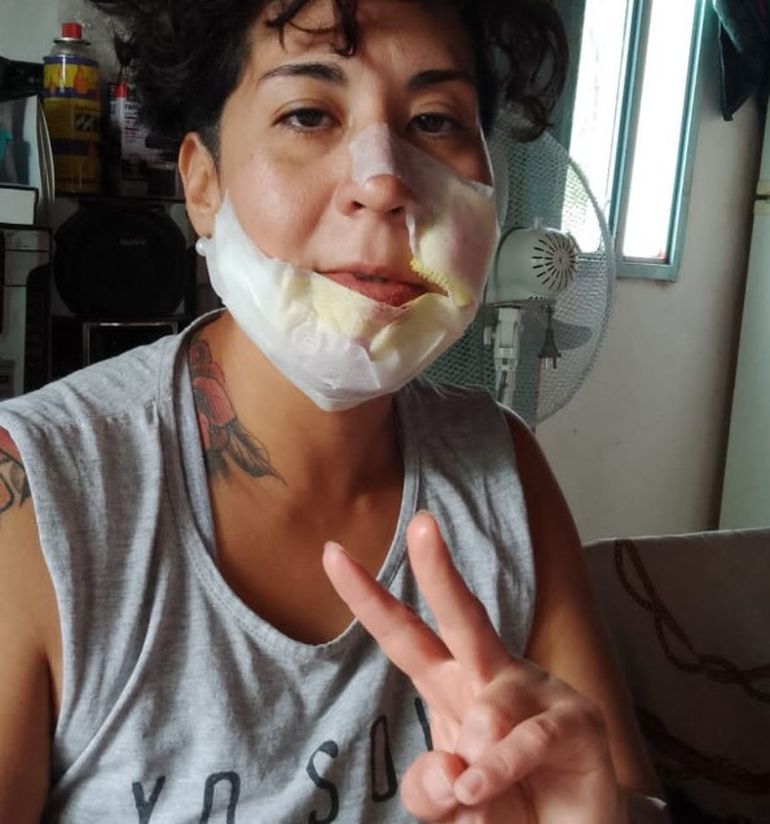 Mariana Gabriela Lillo, la mujer que sufrió el violento ataque de un pitbull en Gaiman, Chubut. Mariana Gabriela Lillo, la mujer que sufrió el violento ataque de un pitbull en Gaiman, Chubut.