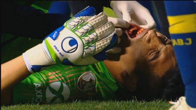 Boca se queda sin Andrada y piensa en otro arquero