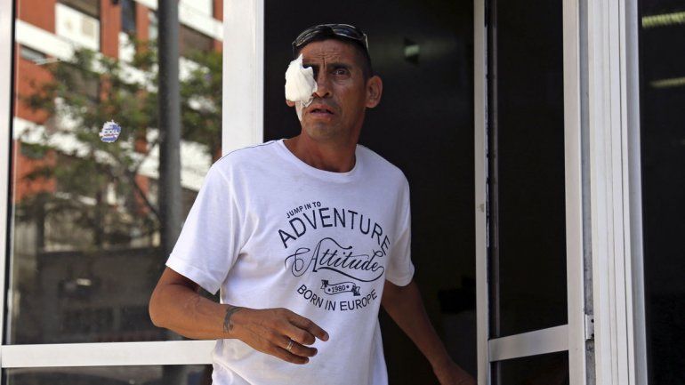 Doce heridos por pirotecnia fueron atendidos en el Hospital del Quemado