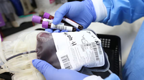 Fin del pedido de donantes para cirugías: los cambios clave en el nuevo sistema nacional de sangre Fin del pedido de donantes para cirugías: los cambios clave en el nuevo sistema nacional de sangre