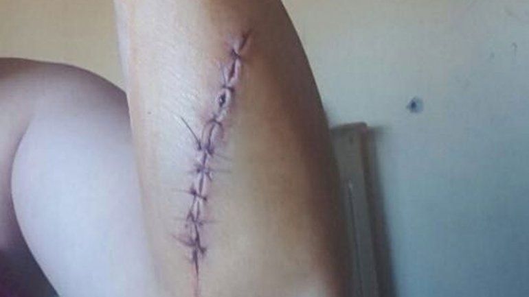 Intentaron robarle a una enfermera del SIEN a cuchillazos