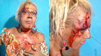 brutal guerra por la prostitucion en la ruta 22: ahora la ligo mamucha brutal guerra por la prostitucion en la ruta 22: ahora la ligo mamucha