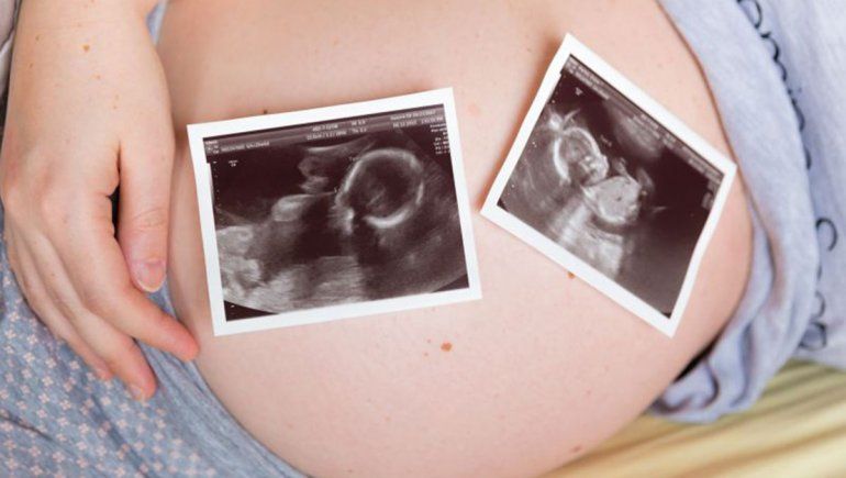 Se embarazó mientras ya estaba gestando gemelos
