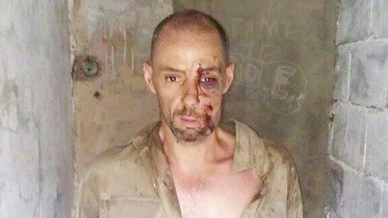 Así quedó Martín Lanatta luego del accidente.&nbsp;