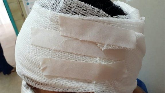 Tildaron de buchón a un policía vecino y lesionaron a otro