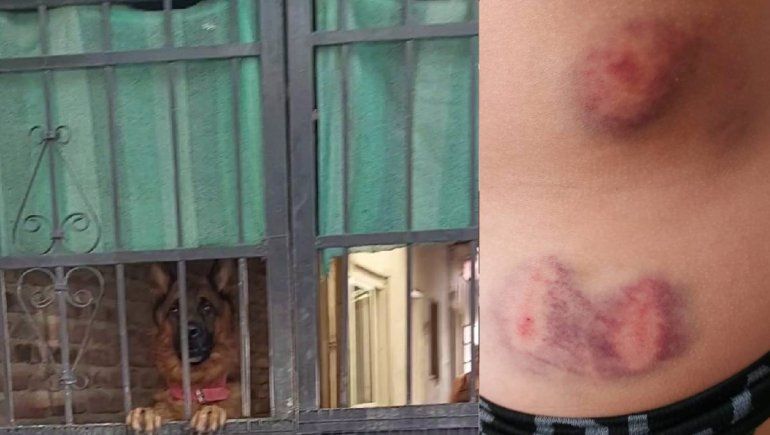 Indignante: un perro atacó a un nene y su dueña no se hizo cargo