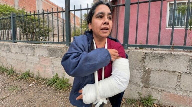 La mujer atacada por los dogos habló tras salir del hospital e hizo una fuerte acusación a los dueños.