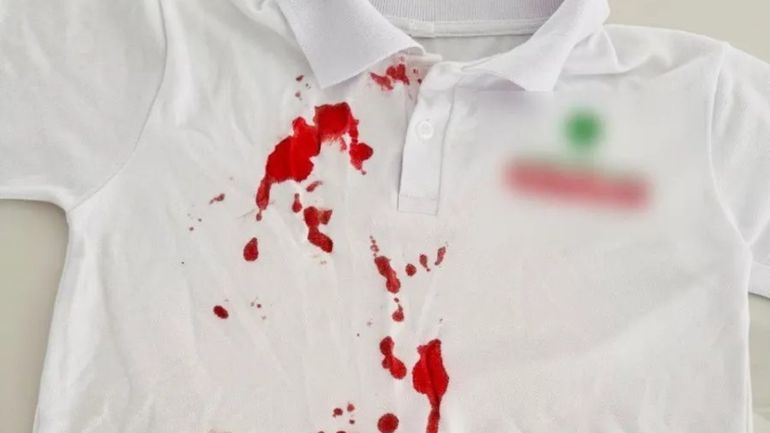 Así quedó la ropa del menor agredido. La situación generó preocupación al interior del colegio.