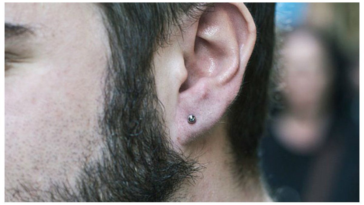 Un Dermato Peut Il Reboucher Un Piercing