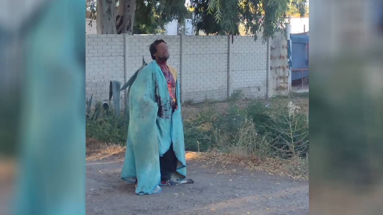Elhombre presentaba heridas en el cuello y provocó preocupación entre los vecinos. Foto: LMC
