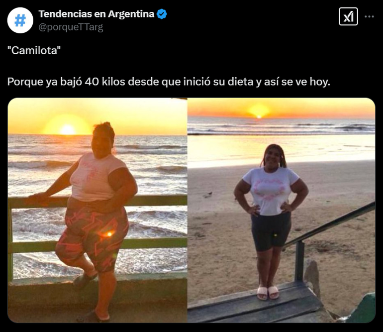 Camilota fue tendencia en redes sociales al mostrar su radical cambio físico. Camilota fue tendencia en redes sociales al mostrar su radical cambio físico. 