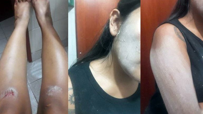 Horror: denunció que un hombre le puso una cuerda en el cuello e intentó secuestrarla