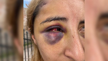 golpeo a su ex hasta darla por muerta; su hija la rescato golpeo a su ex hasta darla por muerta; su hija la rescato