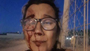 crei que me mataba, conto una sobreviviente crei que me mataba, conto una sobreviviente