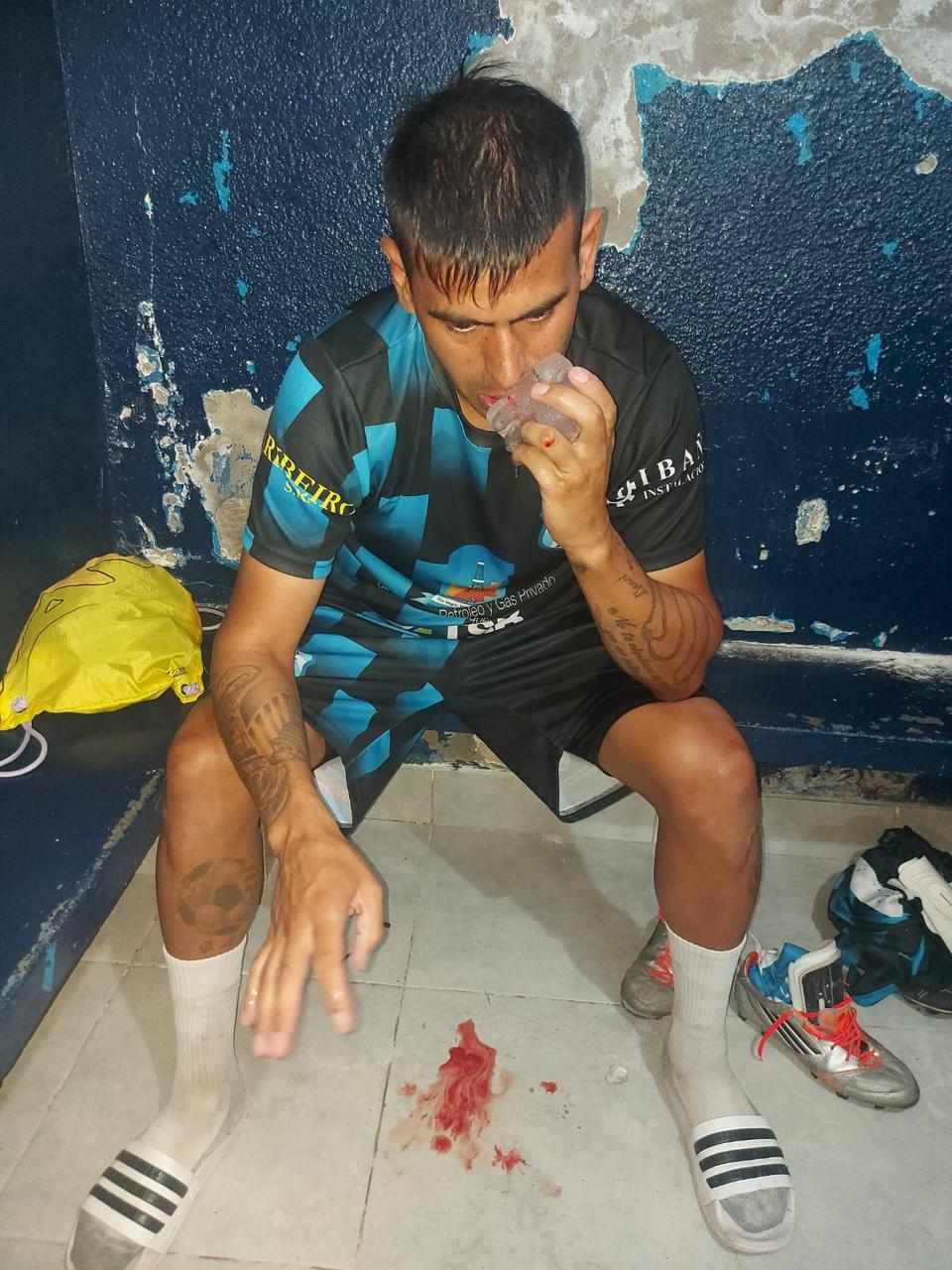 las agresiones a los jugadores de deportivo rincon en comodoro