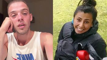 santi maratea ayudara a la cipolena que perdio los brazos y la nariz santi maratea ayudara a la cipolena que perdio los brazos y la nariz