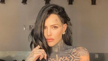 Cande Tinelli se sometió a un nuevo tratamiento estético. Cande Tinelli se sometió a un nuevo tratamiento estético.