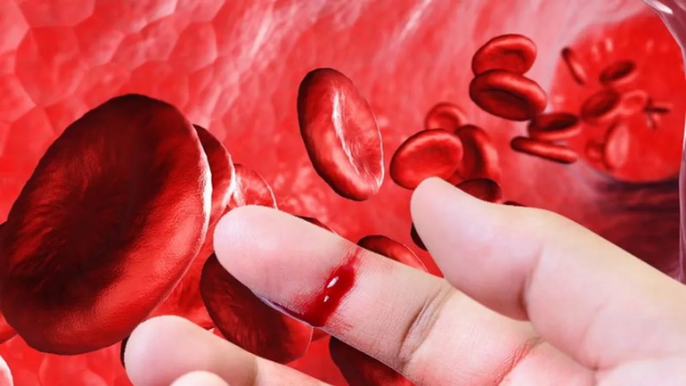 La Hemofilia es una enfermedad genética que precisa un tratamiento de por vida.