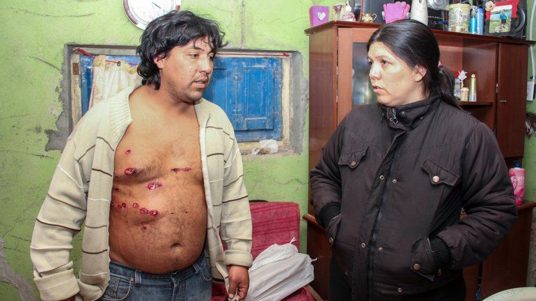 Juan Retamal estuvo algunas horas detenido y luego recibió atención por las heridas en el hospital de Oro.