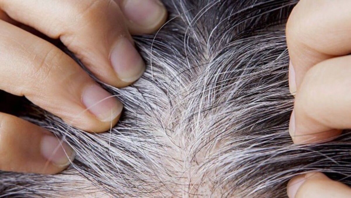 i bien la tintura es la opción más común para cubrirlas, existen alternativas naturales que pueden mejorar la apariencia y la salud del cabello.