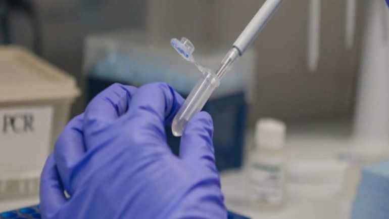 Covid-19: nueva prueba logra detectar anticuerpos hasta hoy invisibles