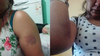 violento escapo de una comisaria y la victima vive con custodia policial violento escapo de una comisaria y la victima vive con custodia policial