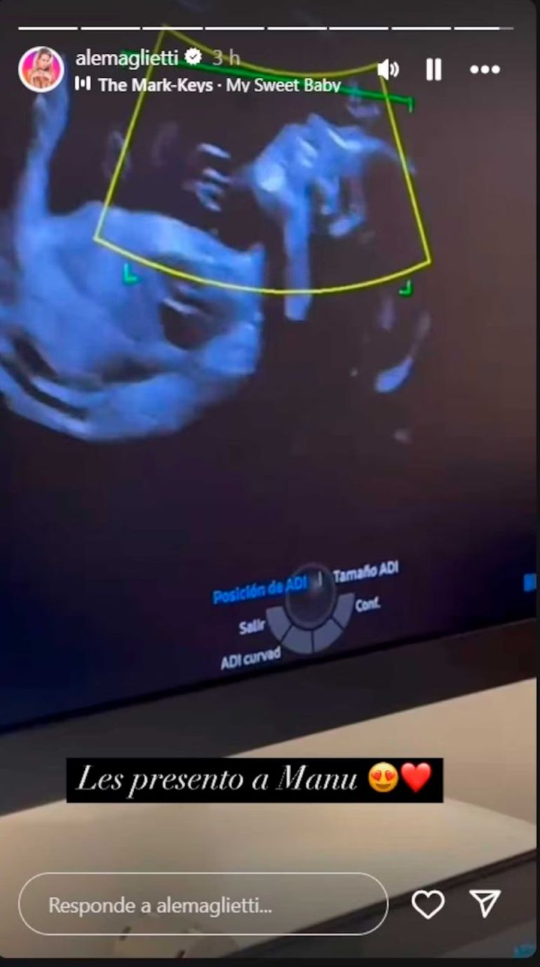 La primera ecografía del hijo de Alejandra Maglietti La primera ecografía del hijo de Alejandra Maglietti