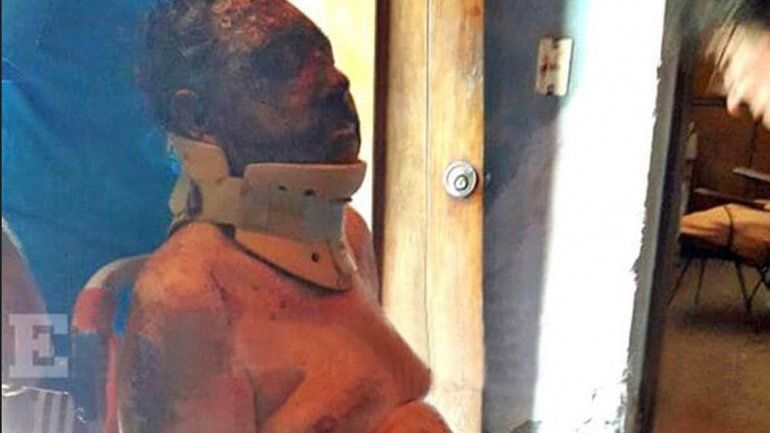 José Armando Scrimini no podía defenderse ante las agresiones.