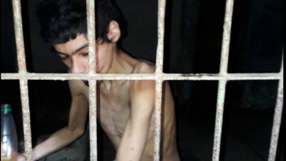 El joven, de 26 años, sufre un severo cuadro de desnutrición.