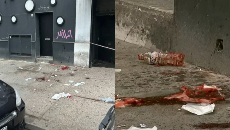 La pelea habría comenzado por el robo de una cadenita dentro del boliche.