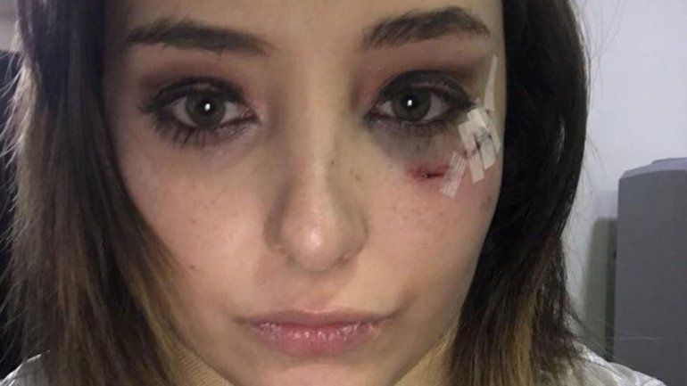 Elisa Vicedo denunció al actor acusándolo públicamente de haberla violado en varias ocasiones hace dos años.