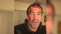 Pablo Cervi, víctima de un violento robo Pablo Cervi, víctima de un violento robo