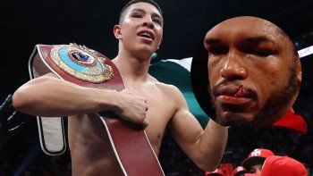 boxeador desfigurado: asi le quedo el rostro tras feroz pelea boxeador desfigurado: asi le quedo el rostro tras feroz pelea