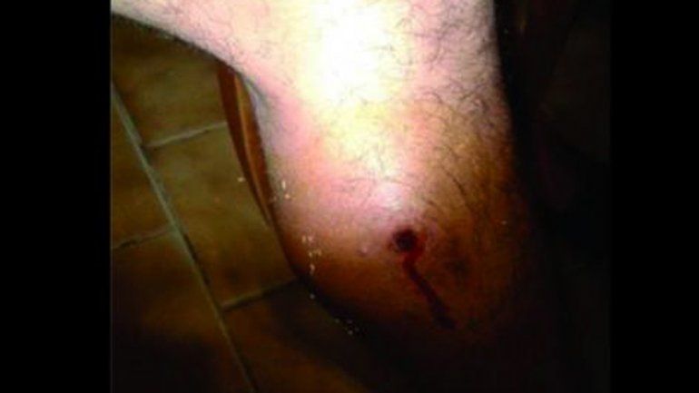 Recibió un balazo mientras pescaba en el río Malleo