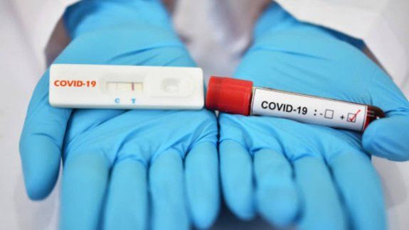Casos mundiales de Covid-19 siguen aumentando en el mundo