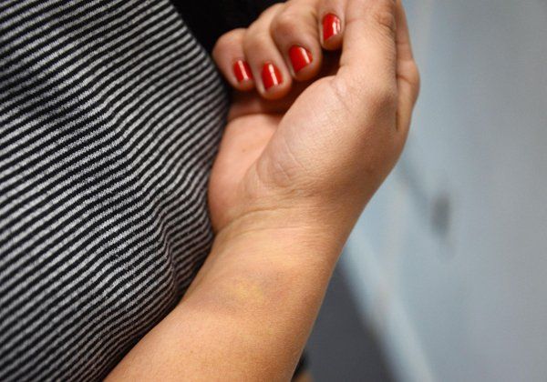 Horror: violó a una chica paralítica y autista de 16 años