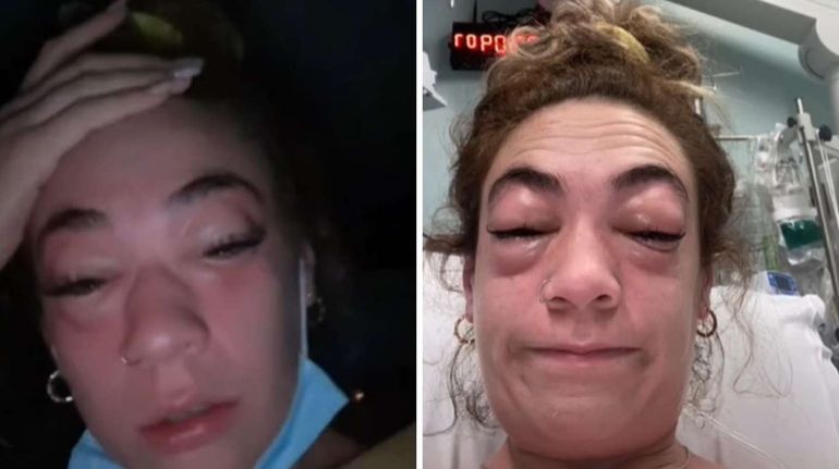 Influencer se puso pestañas y se le deformó la cara