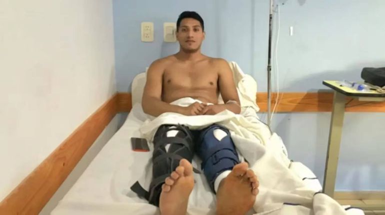 Insólito: un joven fue a hacerse una cirugía en la rodilla y le operaron las dos piernas